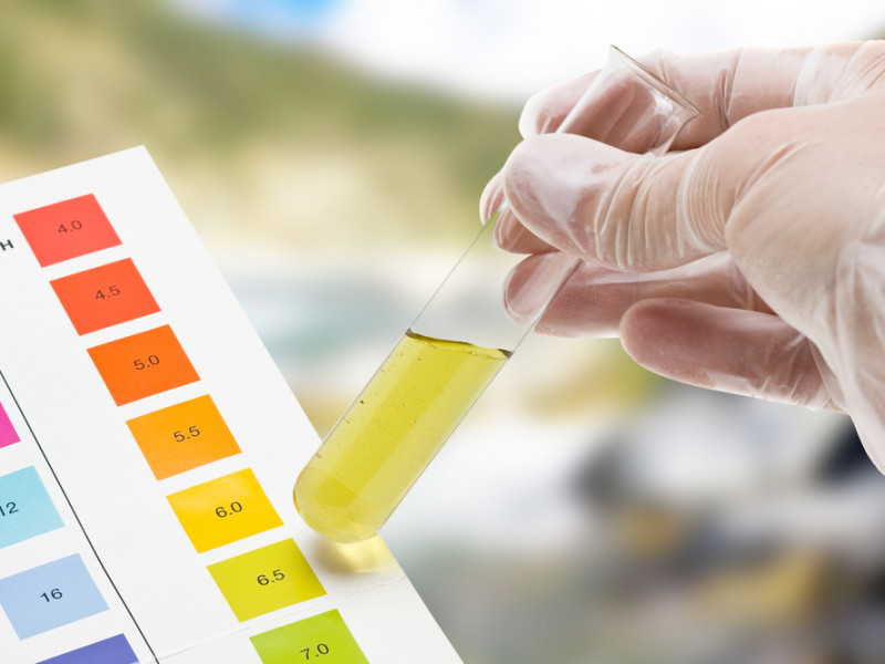 Test per l’autoanalisi delle urine